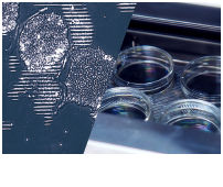 細胞プロセシング